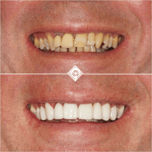 Before & After G. Tidball (1)