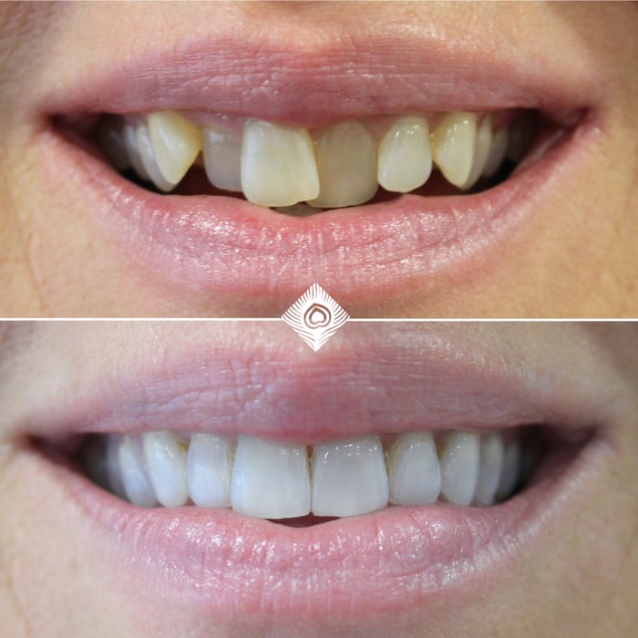 Before & Afters - C. Hill (1)-1
