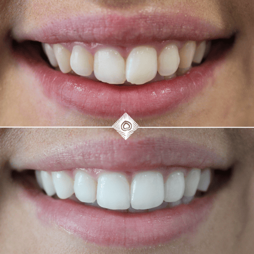 Before & Afters - E. Townsend - 2