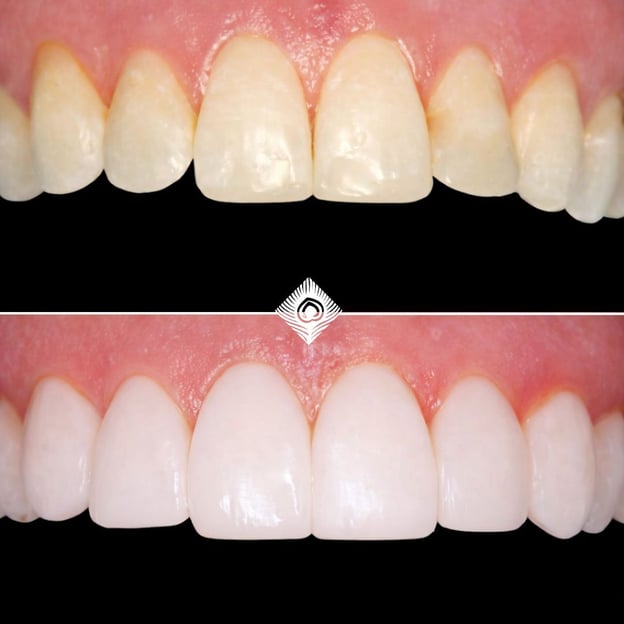 Before & Afters - H. Lye-Smith