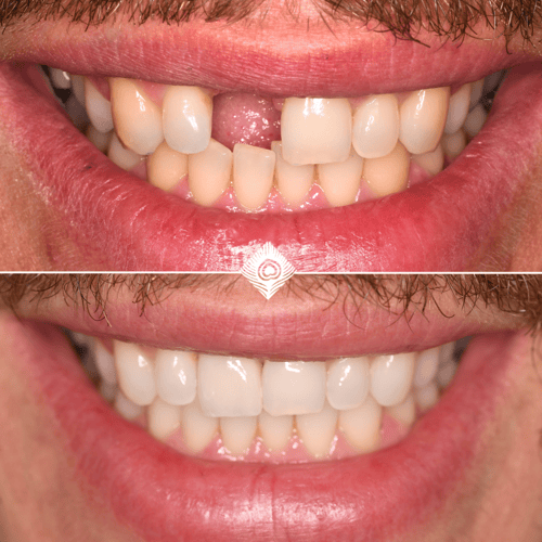 Before and After Carls Logo (6)