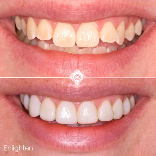 J. Dutton Before & Afters (2)