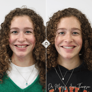 M. George Before & After Pics