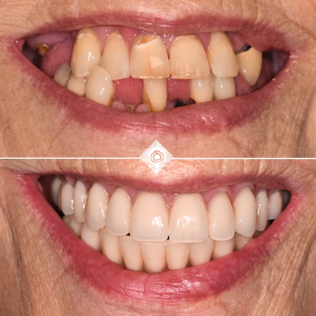 N. Jones Before & After